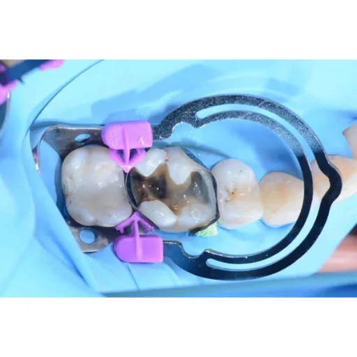 myTines Refill S, M, L, 6 pár