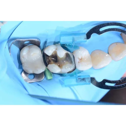 myTines Refill S, M, L, 6 pár