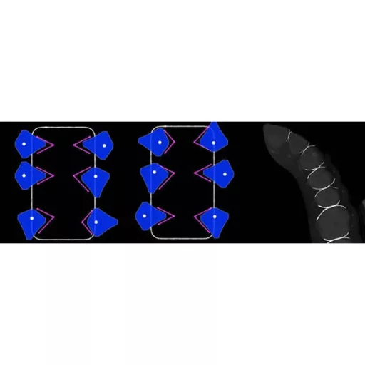 Diamond24, 15 pár