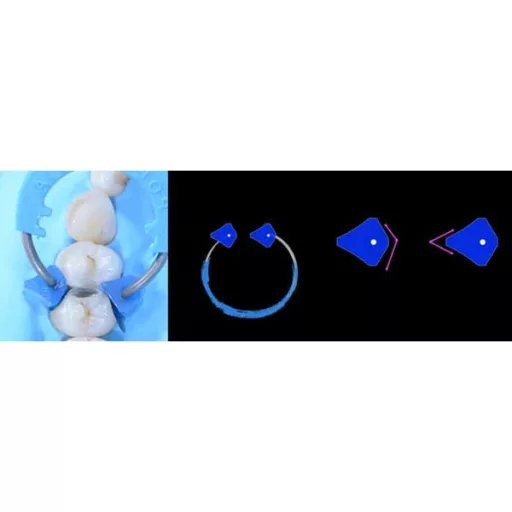Diamond24, 15 pár