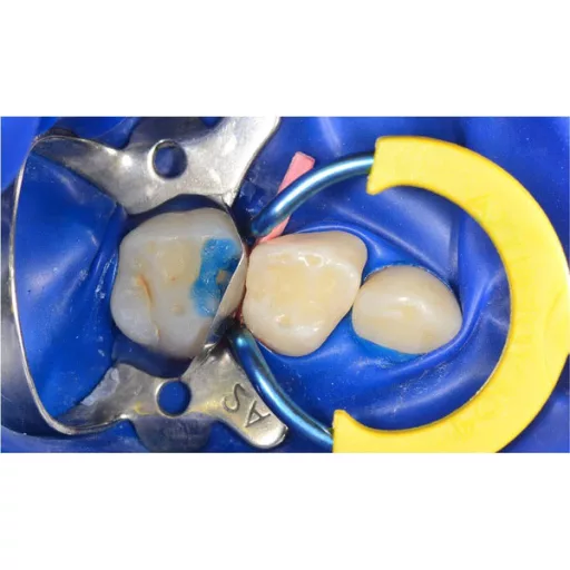 myRing Junior Refill, 2 db.