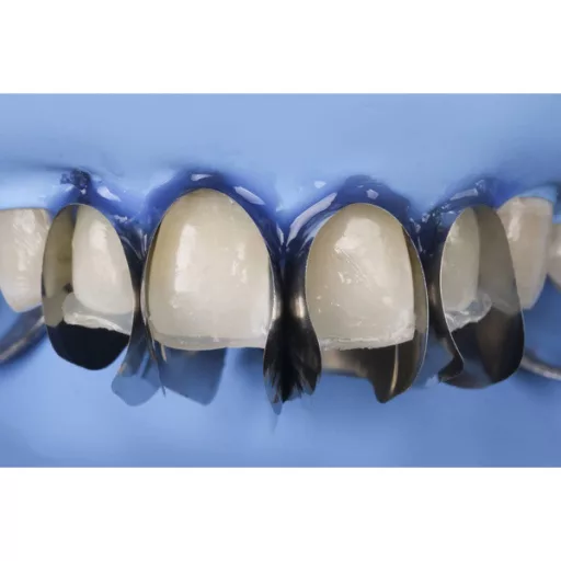 Unica minideep anterior Matrices refill, 12 db.