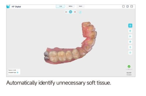 Woodpecker KP Smile2 Intraorális szkenner vezetékes 